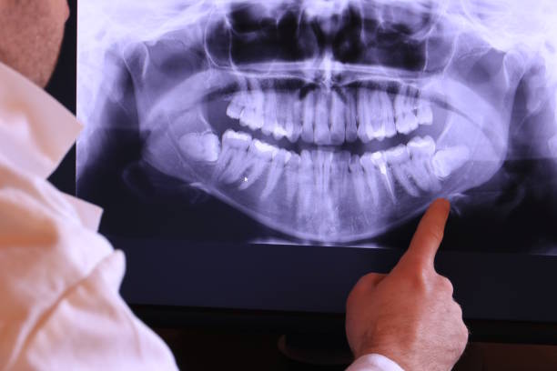 Best Broken Tooth Emergency  in Ahwahnee, CA