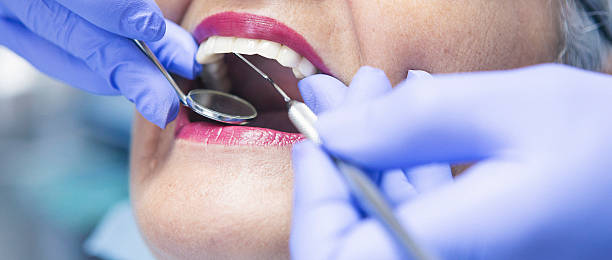 Best Cracked Tooth Emergency Dentist  in Ahwahnee, CA