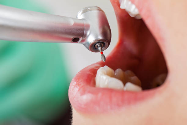 Best Walk-In Dentist Near Me  in Ahwahnee, CA